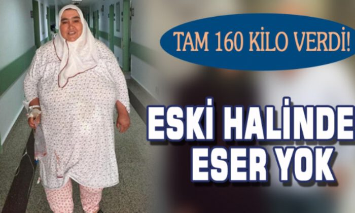 Eski Halinden Eser Yok, Tam 160 Kilo Verdi