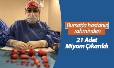 Bursa’da hastanın rahminden 21 miyom çıkarıldı